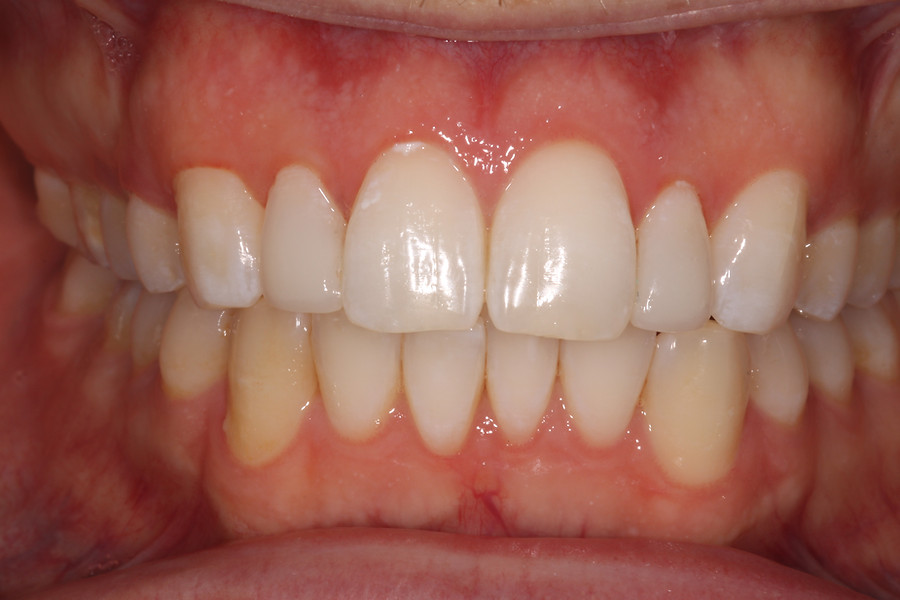 Cosmetic Dentistry — after