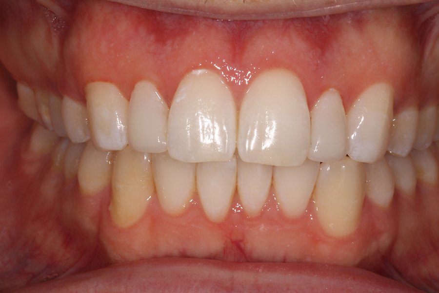 Cosmetic Dentistry — after