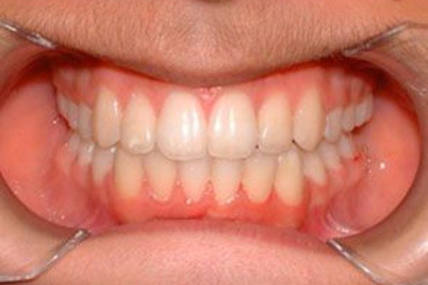 Orthodontics
